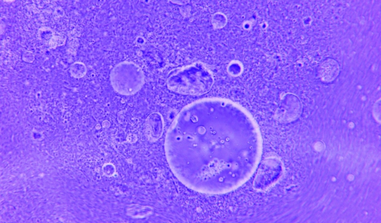 RNA Damlacıkları Mutasyon ile Gelişiyor